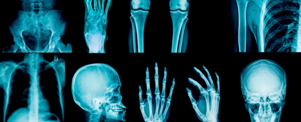 This Italian family feels no pain, and scientists finally understand why