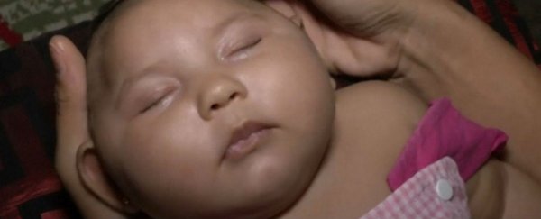 We just got more evidence of the troubling ways Zika may affect pregnant women