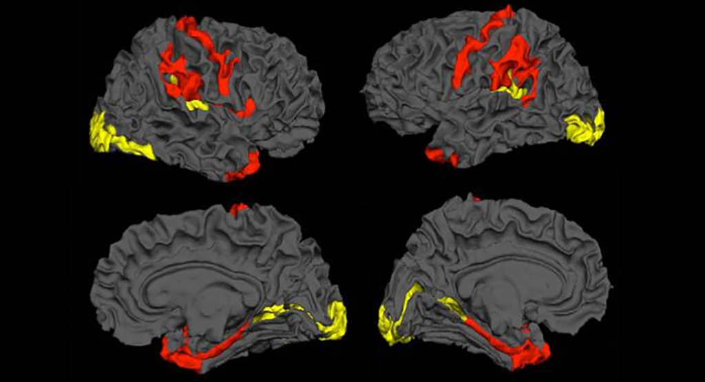 brain-scans