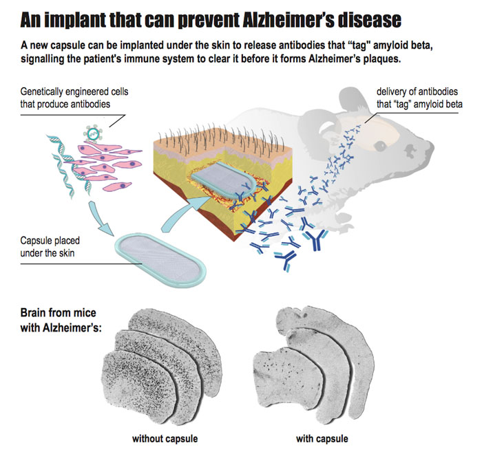 mice-alz-cap-2