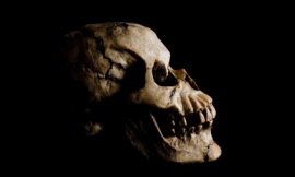GatorDawg_-_human_skull