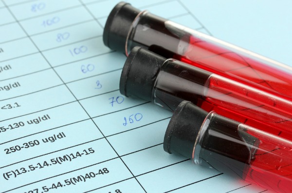 AfricaStudio_bloodtest_shutterstock
