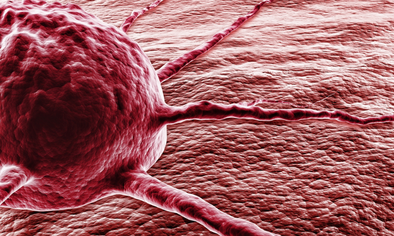 BioMedical_Cancer_shutterstock