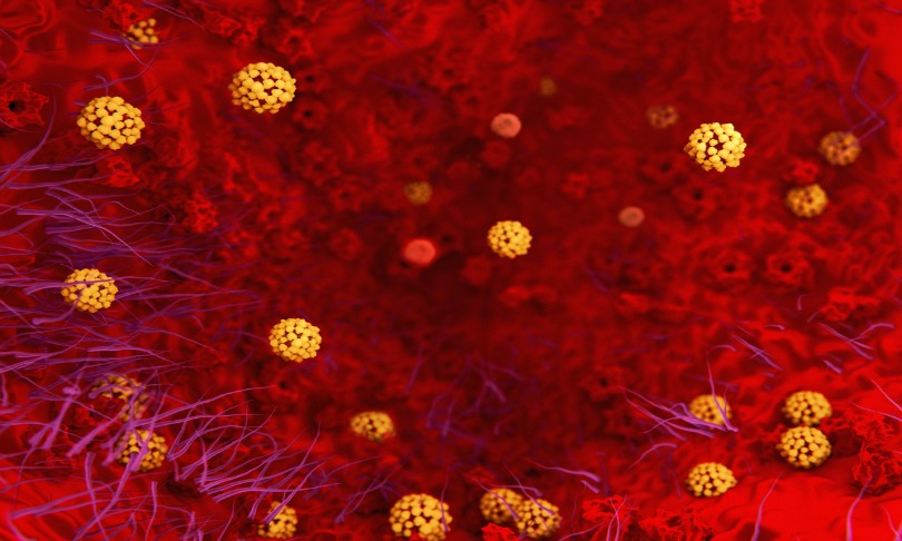 JuanGaertner_pneumonia_shutterstock