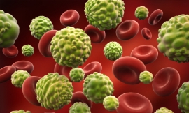 adventtr_-_cancer_cells