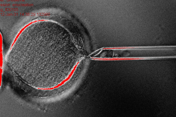 enucleation_wide-ad93d864f62a80d56d7e2259982fb59d89a45729-s40-c85