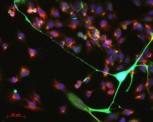 mammary_stem_cells_sm mammary_stem_cells_sm