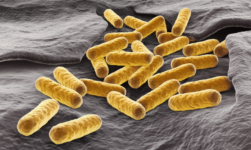 martynowi.cz_EColi_shutterstock
