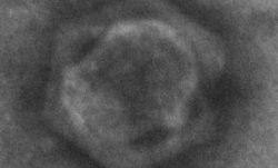 rick_cavicchioli_-_transmission_electron_micrograph_of_a_negatively_stained_virus-like_particle_from_organic_lake_which_resembles_a_phycodnavirus_or_pv.jpg rick_cavicchioli_-_transmission_electron_micrograph_of_a_negatively_stained_virus-like_particle_from_organic_lake_which_resembles_a_phycodnavirus_or_pv.jpg